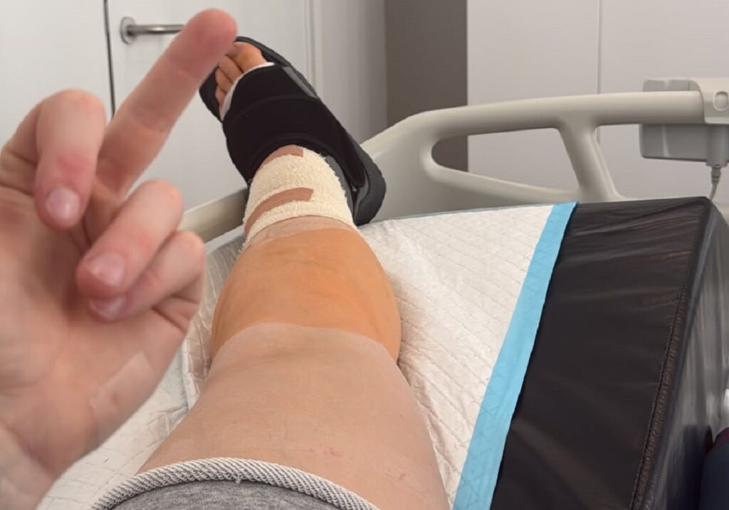 Hannah Botterman shows her injury